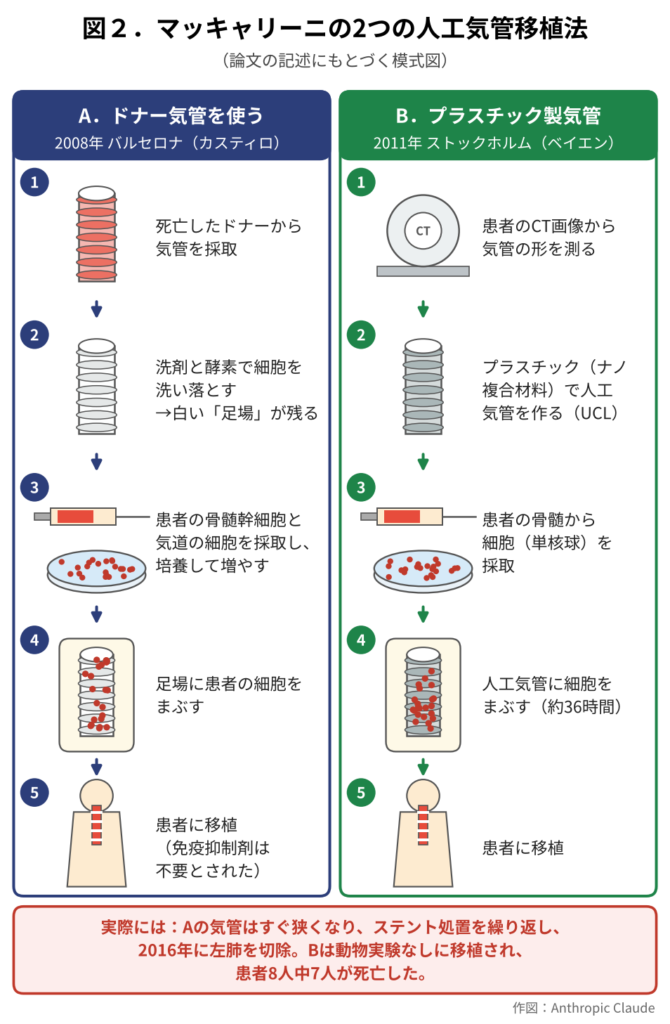 マッキャリーニの2つの人工気管移植法